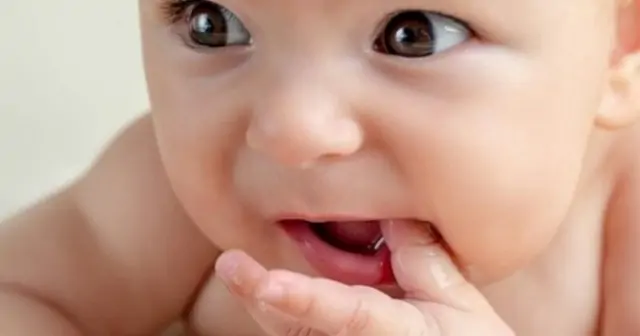 5 Ciri Gejala Tumbuh Pada Gigi Bayi